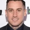 Carey Hart